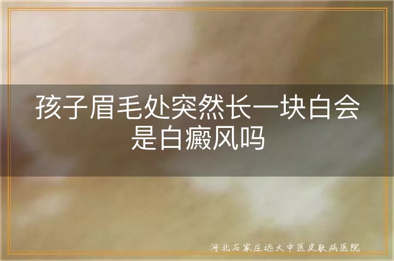 儿童眉毛处白斑鉴别,白癜风与儿童白斑区分,儿童白斑可能病因