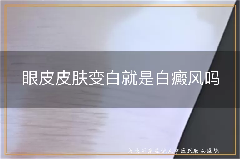 眼皮白斑是否为白癜风,白癜风眼皮症状鉴别,眼皮出现白斑的常见病因