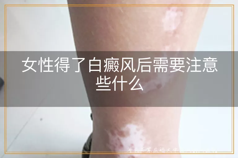 女性白癜风日常护理注意事项,白癜风患者皮肤保护指南,女性白斑病饮食调理方法