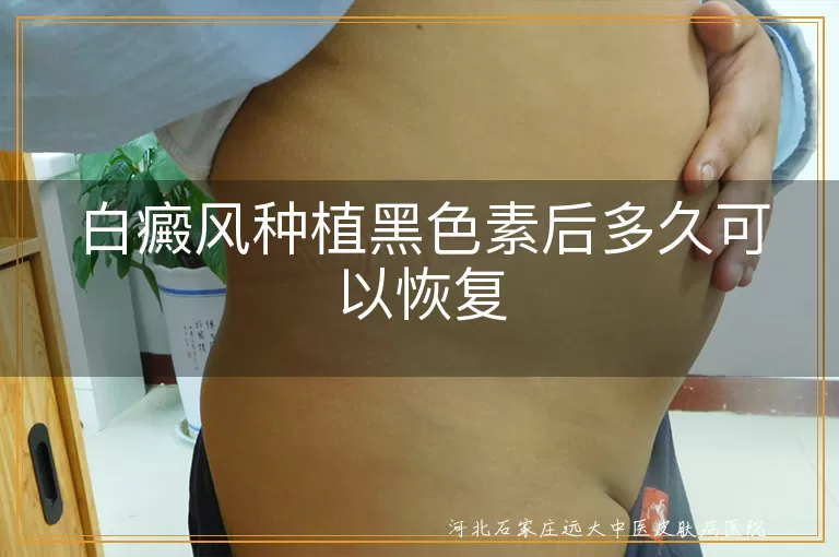 白癜风黑色素种植恢复周期,白斑种植术后恢复时间,黑色素移植效果观察期