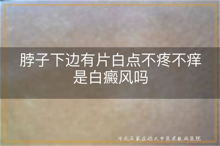 颈部白斑是否为白癜风,脖子白斑不痛不痒的原因,白斑与白癜风鉴别方法