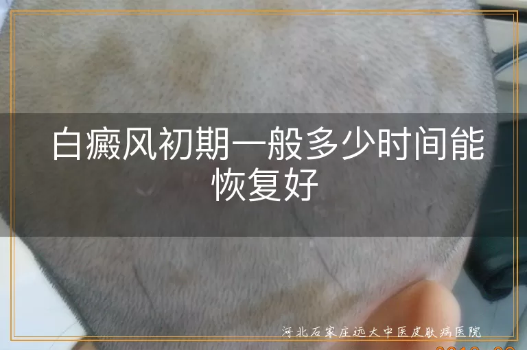 白癜风初期一般多少时间能恢复好