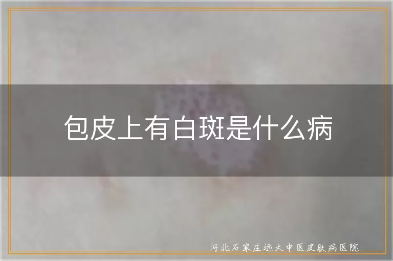包皮上有白斑是什么病