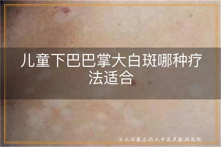 儿童下巴白癜风治疗选择,手掌白斑新方案,儿童面部白斑治疗策略