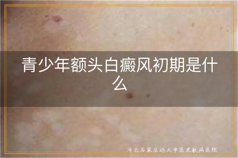 白癜风初期额头白斑特写,青少年早期白斑如何识别,白斑扩散真相揭秘