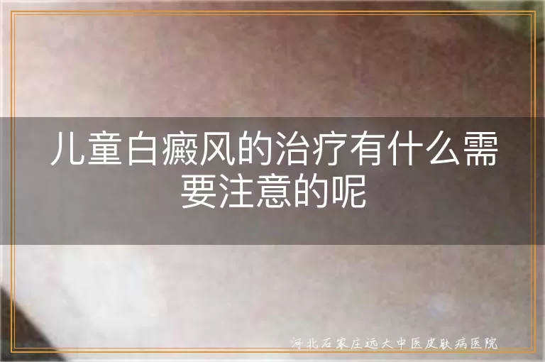 儿童白癜风的治疗有什么需要注意的呢