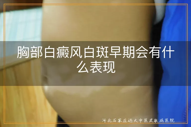 胸部白癜风早期症状,白斑初现时的表现,白癜风初期特征变化