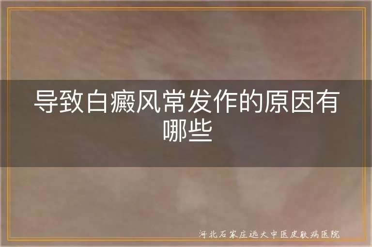 白斑反复发作的幕后推手,白癜风加重元凶盘点,白斑春季高发的隐形诱因