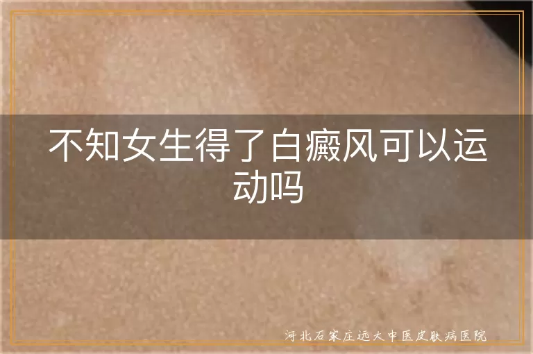 女生白斑日常锻炼注意事项,轻度白癜风运动指南,白癜风女生锻炼建议