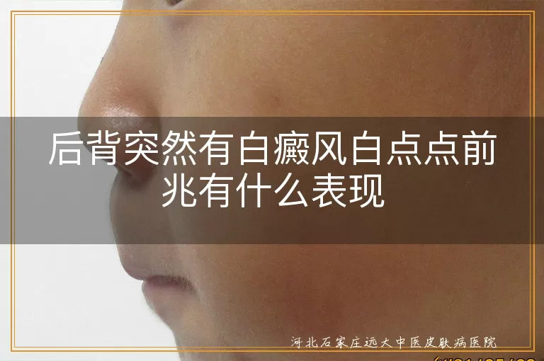 后背突然有白癜风白点点前兆有什么表现