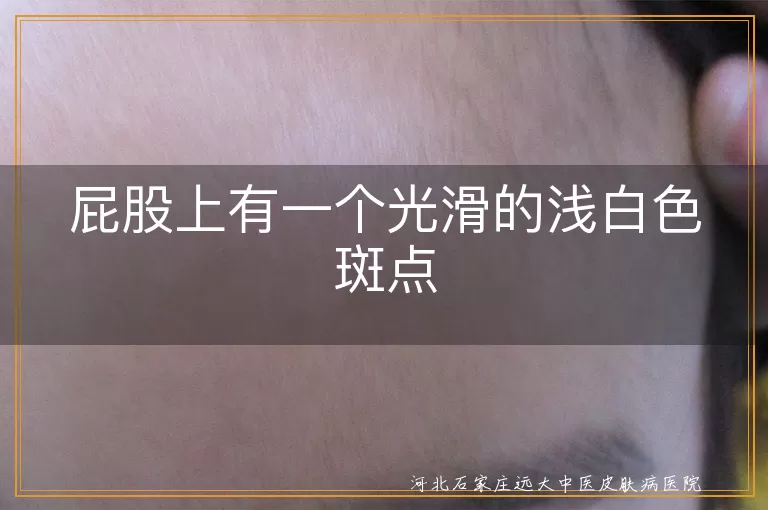 屁股上有一个光滑的浅白色斑点