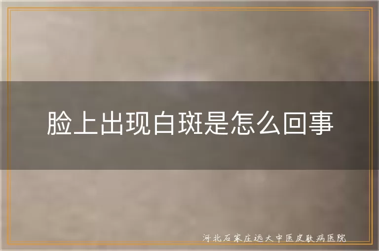 脸上长白斑是白癜风吗,嘴角白斑的诱因解析,面部白斑自我辨认技巧