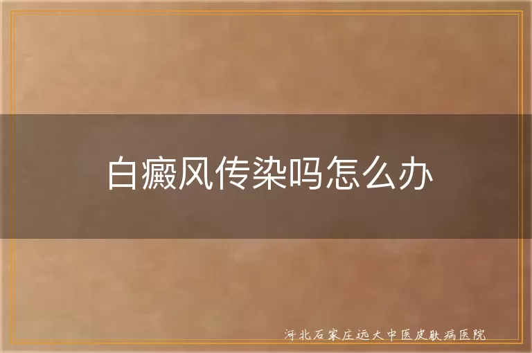 白癜风会不会传染,白斑会传染给身边人吗,白癜风日常怎么自我保护