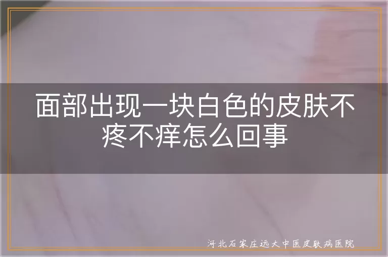 面部白斑是不是早期白癜风,脸上突然变白不疼不痒白斑原因,面部白癜风初期怎么治疗