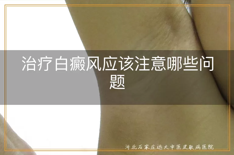 白癜风初期治疗注意事项,白斑扩散应如何及时干预,中医调理白斑体质关键点