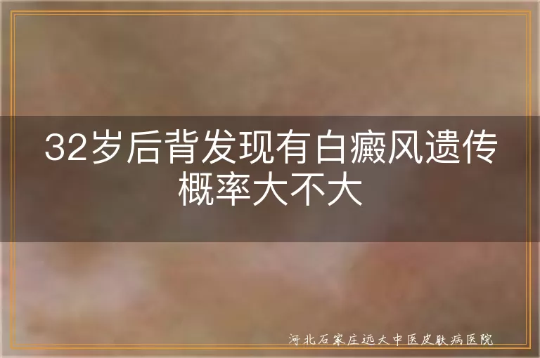32岁后背发现有白癜风遗传概率大不大