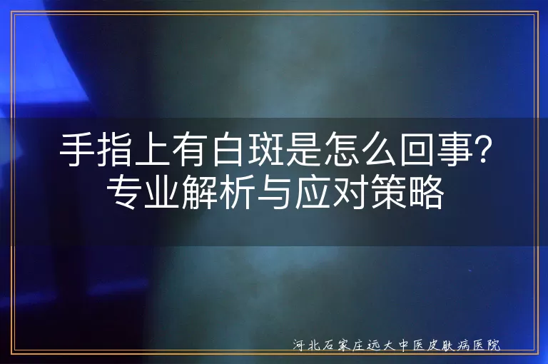 手指白癜风诱因探析,手指白斑治疗方案,白癜风日常护理注意