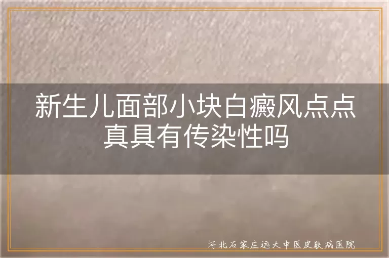 新生儿面部白癜风不会传染,宝宝白斑扩散误区,新生儿白癜风家长应对