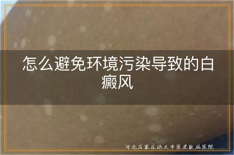 怎么避免环境污染导致的白癜风