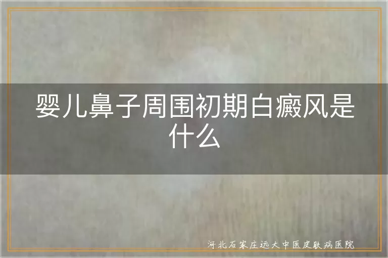 婴儿期鼻周白癜风,白斑初期科普,小白斑是白癜风吗