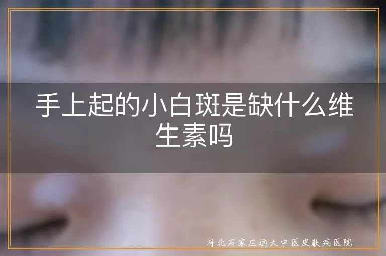 手上出现白斑是否维生素缺乏所致,手部白癜风早期症状表现,小白斑是否属于白癜风疾病