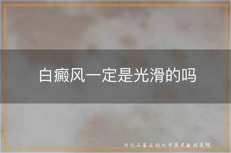 白斑表面会起屑吗,白癜风触感解析,白癜风皮肤变化真相