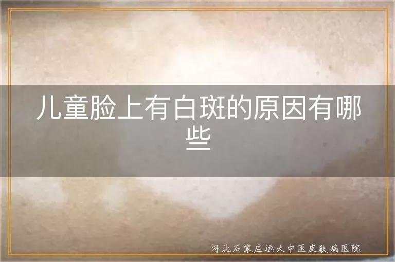 儿童脸上有白斑的原因有哪些