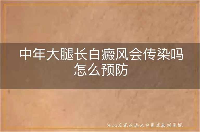 中年大腿长白癜风会传染吗怎么预防