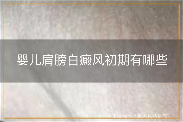 婴儿肩膀白癜风初期有哪些