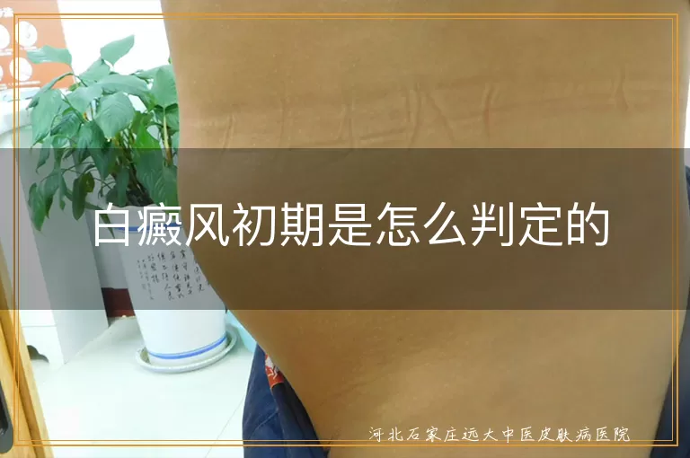 白癜风初期是怎么判定的