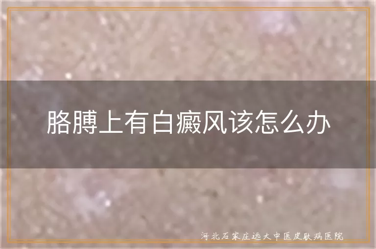 发现胳膊白斑如何护理,胳膊患白癜风应对要点,手臂白癜风早期干预策略