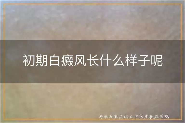 初期白癜风长什么样子呢