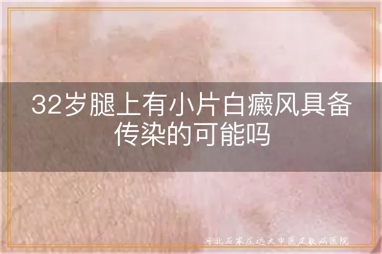 32岁白癜风传染疑虑,腿部白斑是否传播,白癜风日常预防措施