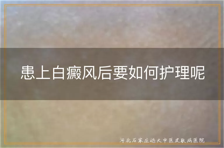 白斑患者日常护理手册,白癜风饮食与作息攻略,白斑皮肤保湿防晒宝典
