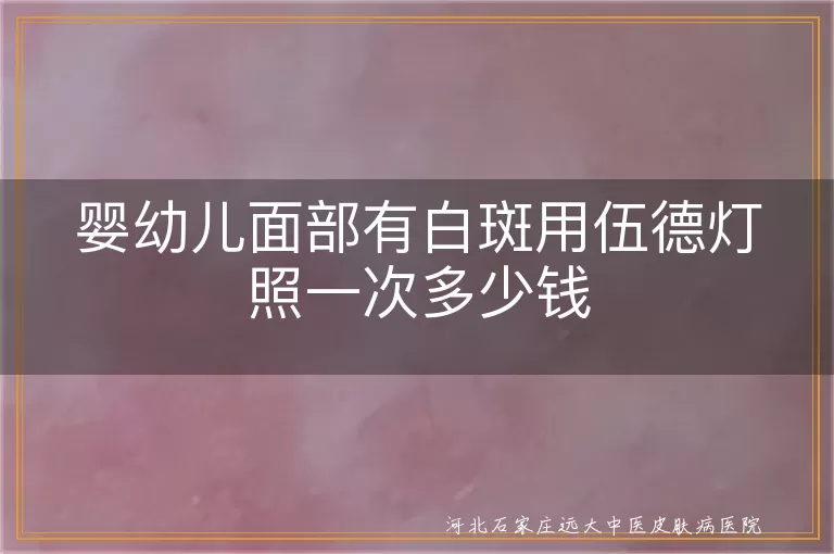 婴幼儿面部有白斑用伍德灯照一次多少钱