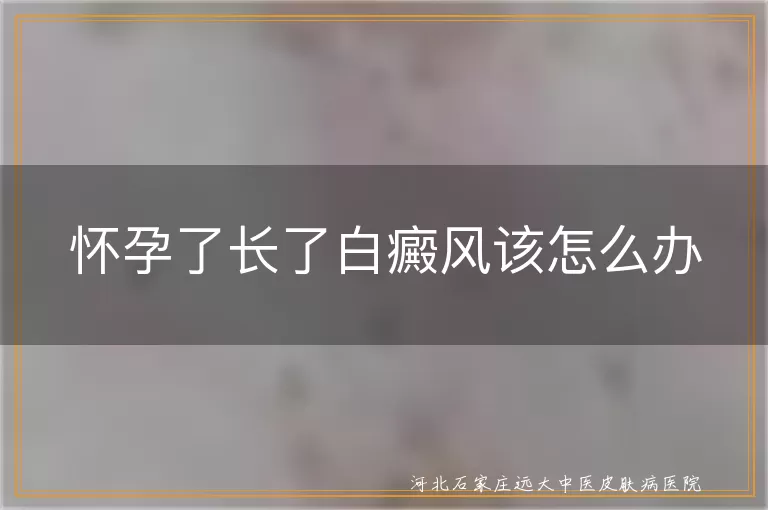 怀孕了长了白癜风该怎么办