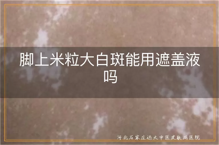 脚上米粒大白斑能用遮盖液吗