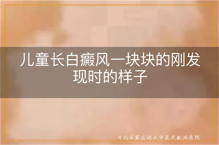 儿童早期白癜风斑块,白斑初现症状观察,小朋友刚得白癜风表现