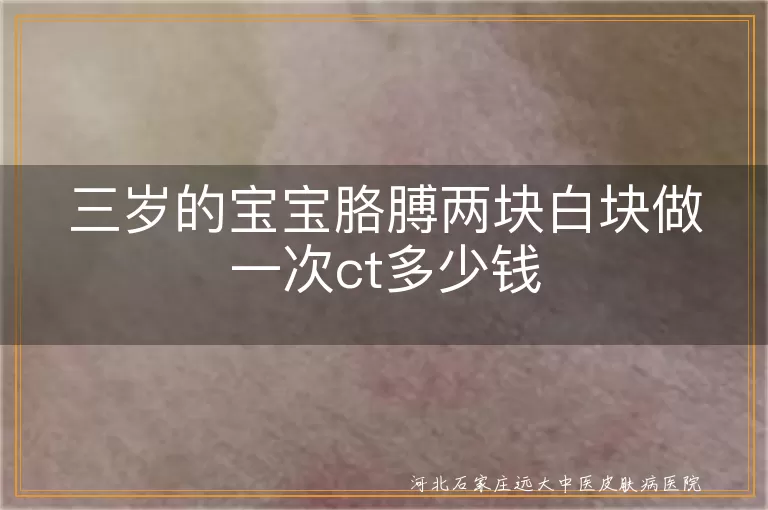 三岁的宝宝胳膊两块白块做一次ct多少钱