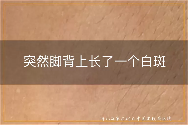 突然脚背上长了一个白斑