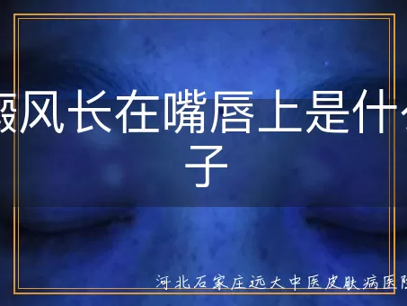 白癜风长在嘴唇上是什么样子