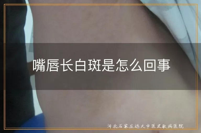 嘴唇长白斑是怎么回事