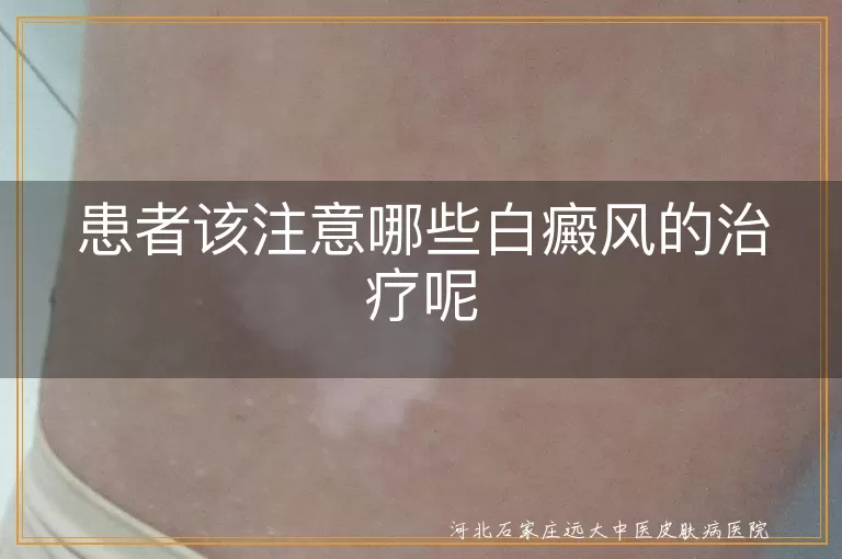 白癜风治疗注意事项,白斑护理妙招,白癜风日常防护