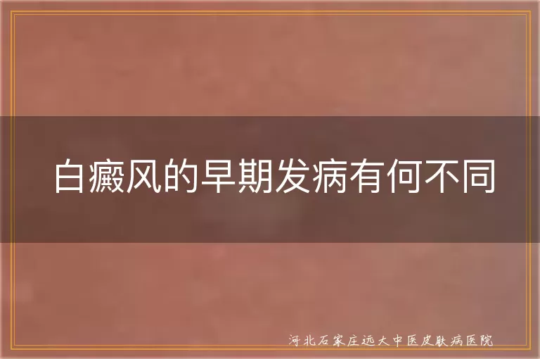 白癜风的早期发病有何不同