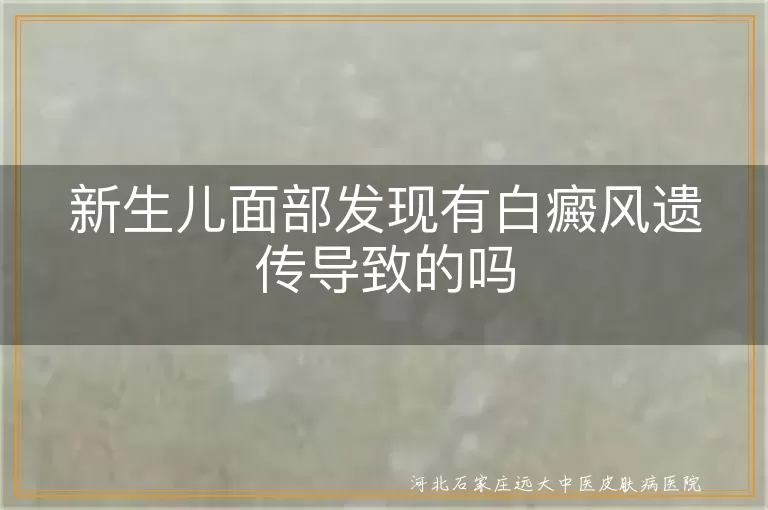 新生儿面部白斑是否遗传了白癜风,婴幼儿早期白癜风家族遗传可能性,初生宝宝脸上有白斑是白癜风吗