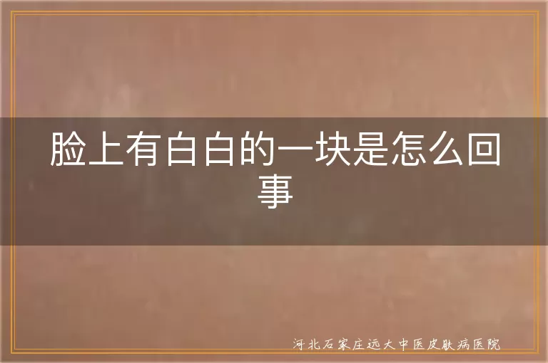 面部白斑是什么原因,脸上白癜风怎么办,白斑症状如何辨别