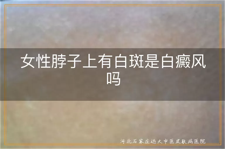 女性颈部白斑是白癜风,白癜风早期症状判断,女性颈部白斑与白癜风区别
