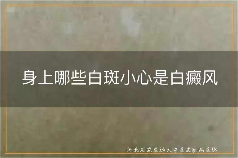 身上哪些白斑小心是白癜风