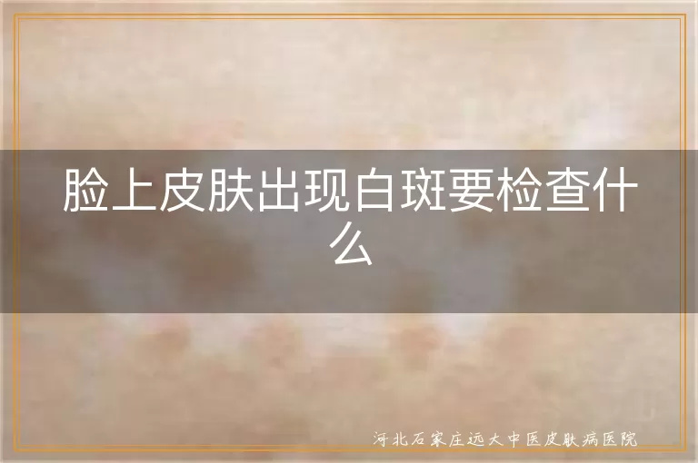 脸上白斑需做三项检查,白癜风患者就诊指南,面部突然白斑如何自检