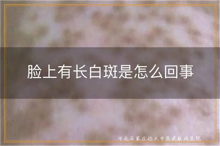 脸上突然冒出白斑怎么办白癜风,脸上浅色斑块是白斑还是白癜风,脸上斑驳白斑疑似白癜风